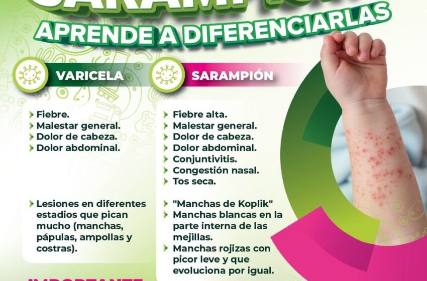  Refuerzan campaña informativa en San Luis Potosí para diferenciar sarampión y varicela